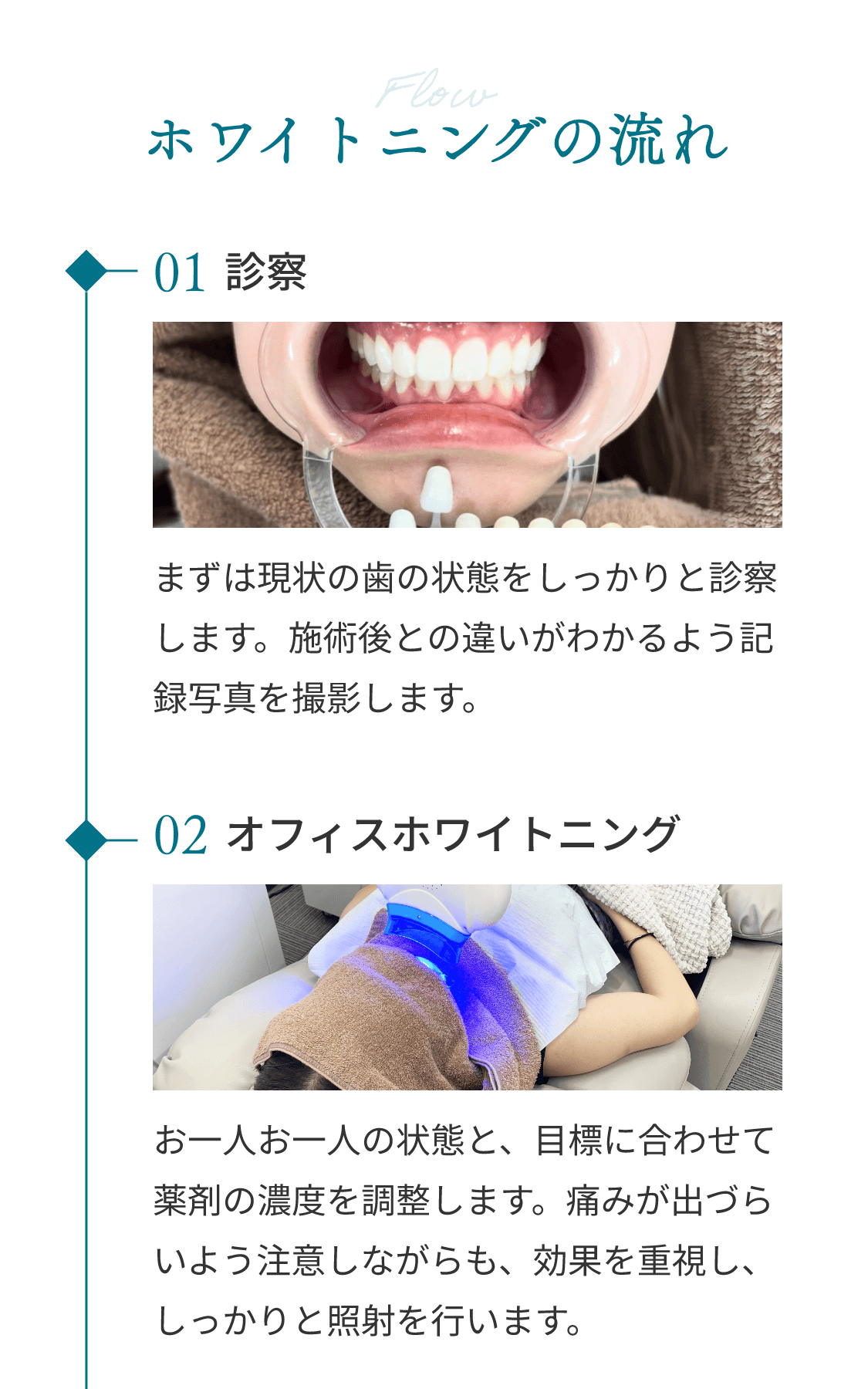 ホワイトニングの流れ